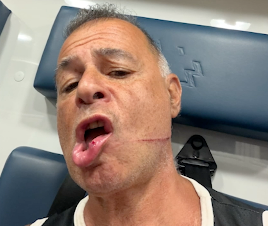 penn station victim wounds